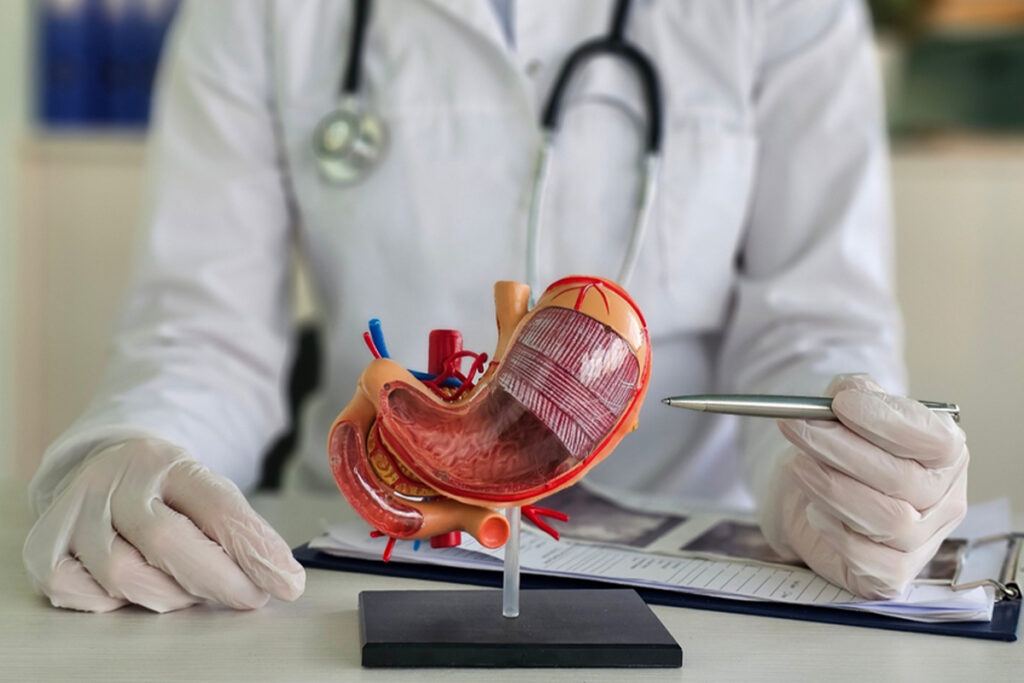 Gastrisk bypass i Turkiet